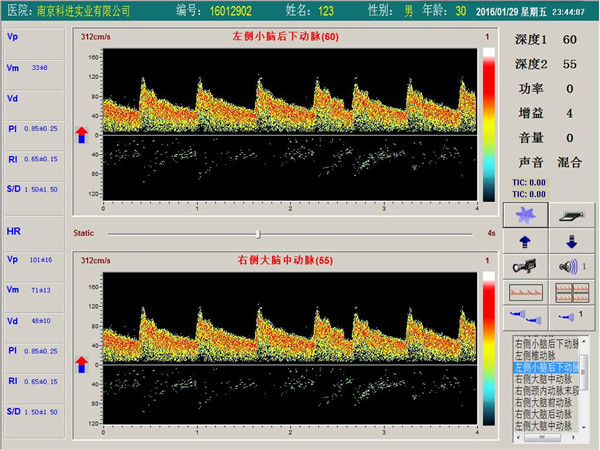 經(jīng)顱多普勒雙通道，單深度界面