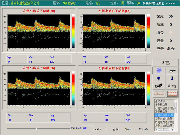 經(jīng)顱多普勒單通道，四深度界面