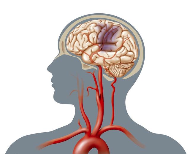 因病致死一半是由心腦血管疾病引起的