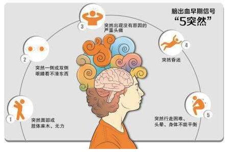 心腦血管病別等發(fā)作才篩查，經(jīng)顱多普勒TCD超聲檢測心腦血管