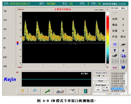 經(jīng)顱多普勒軟件CW模式下單窗口檢測界面